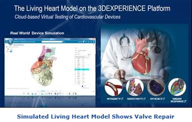 Simulated Living Heart Model Shows Valve Repair  jads3.JPG